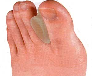 Toe Spreaders