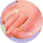  Click to view Toe Separators