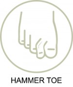 Wide Fitting Shoes For Hammertoes